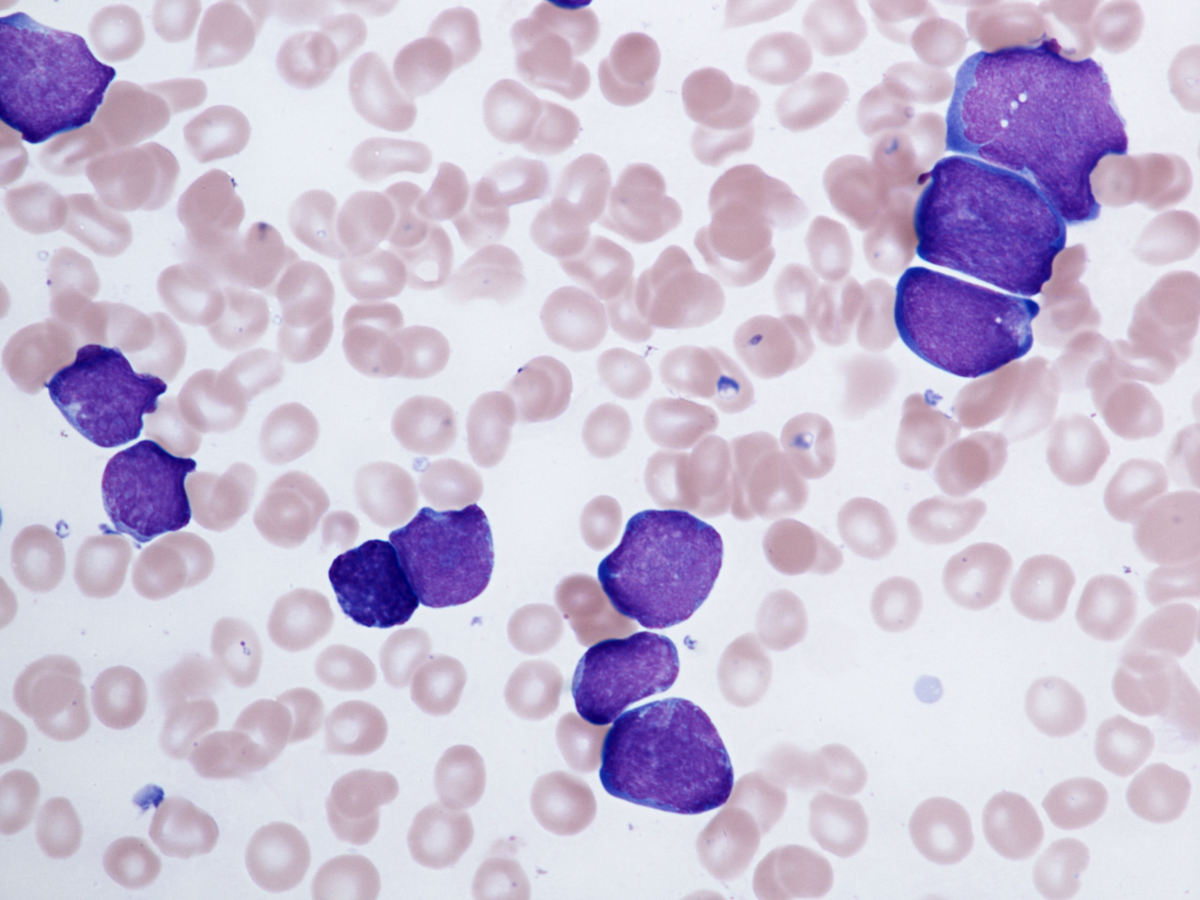 bone marrow aspirate
